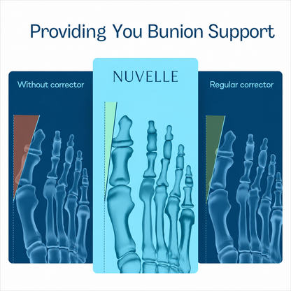 Realyn Pro — EMS Toe Alignment Support